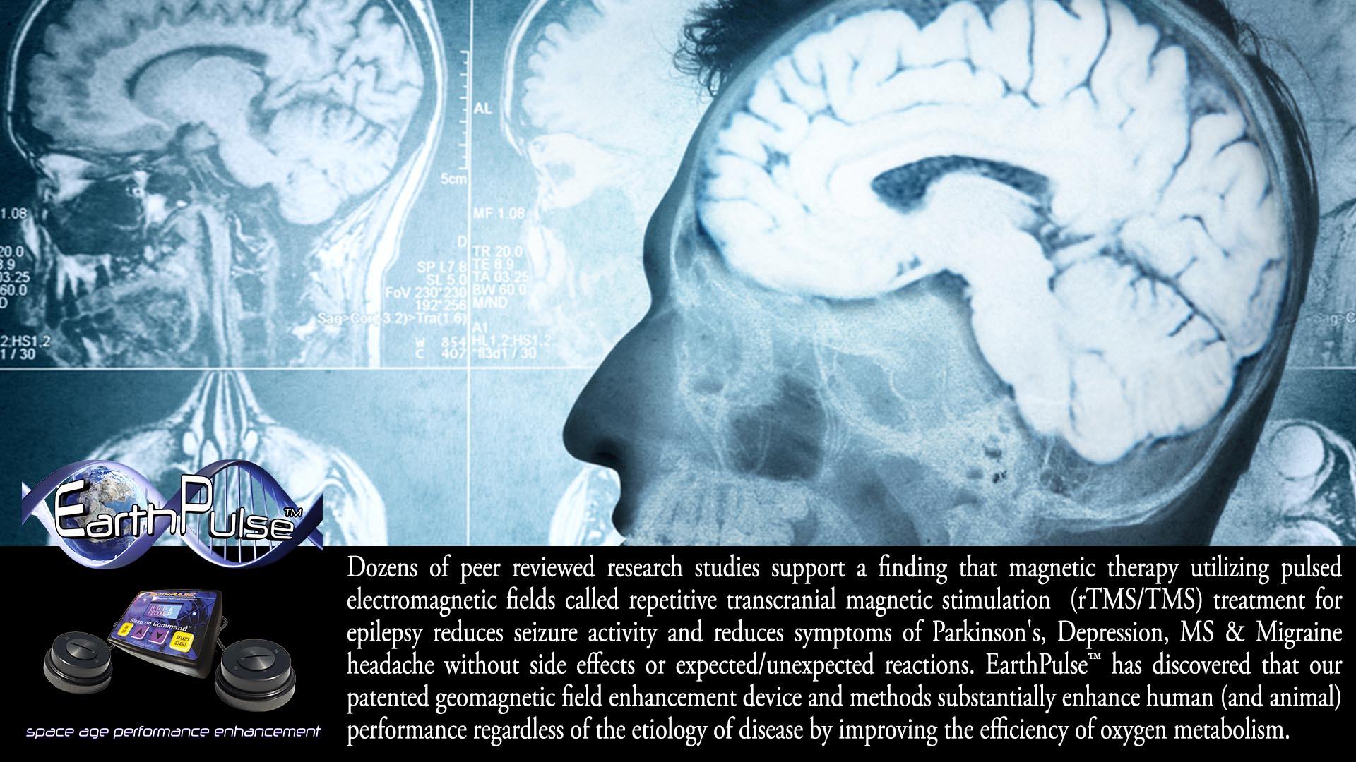 Therapy treatment for Epilepsy Pulsed Field